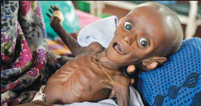 Blockade imposed on Durihamy City causes deaths of patients, children