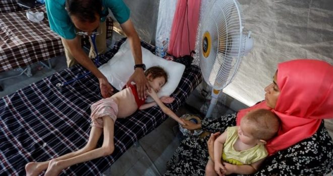 Hunger, malnutrition claim 18 Palestinians in Gaza in 24 hours amid ongoing enemy aggression