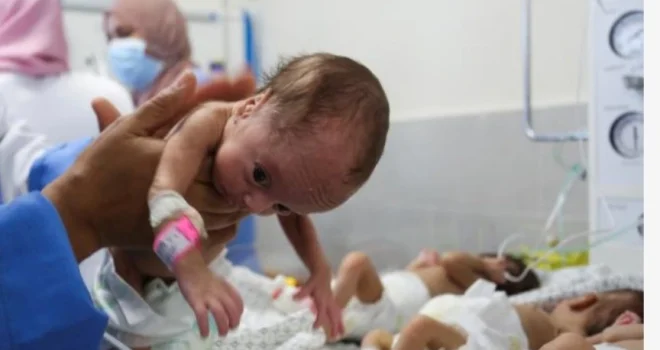 Gaza Health Ministry: Sharp Rise in Anemia Among Children