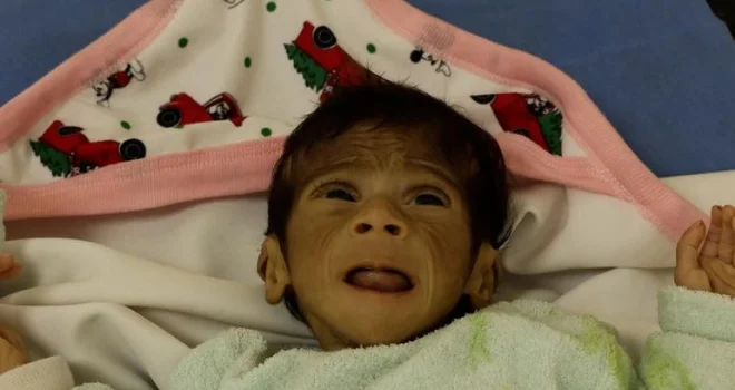 UNICEF warns of disease outbreaks among Gaza children, calls for increased humanitarian aid