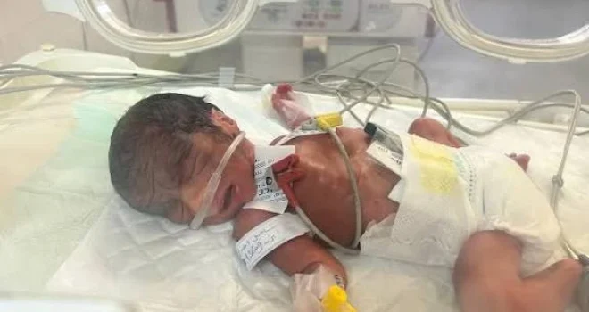 Al-Barsh: Severe Drug Shortages Lead to Significant Increase in Birth Defects in Gaza