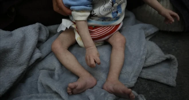 Gaza Health Ministry: Infant Dies