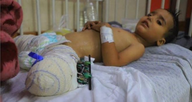 WHO: More than 43,000 injured in Gaza