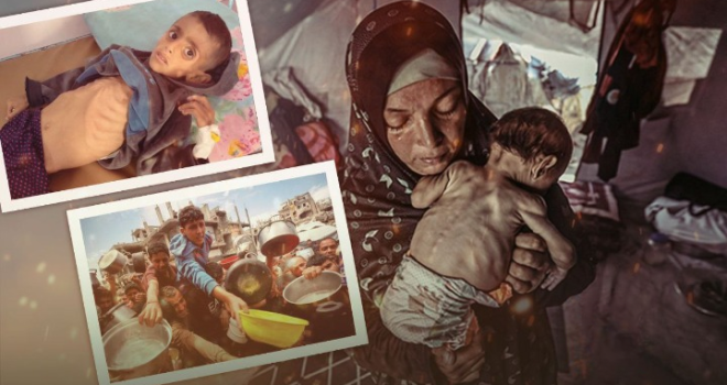 Gaza Between Hunger and Epidemic: A Humanitarian Tragedy Worsens Under Siege